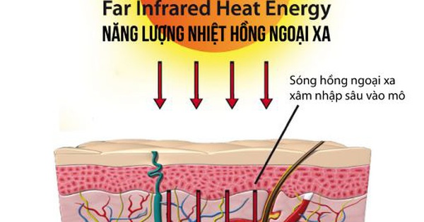 Tia hồng ngoại xa hỗ trợ điều trị các bệnh cơ xương khớp