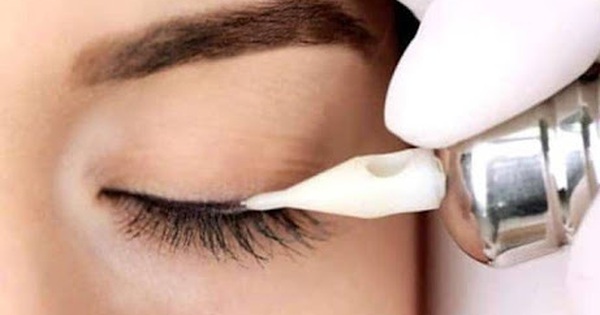 Xăm mí mắt là phương pháp thẩm mỹ nào để tạo đường viền mi mắt?