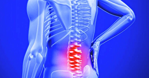 Ung thư cột sống thắt lưng có triệu chứng đau như thế nào và làm thế nào để điều trị?