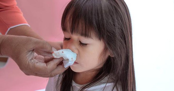  Chảy máu mũi ăn gì : Cách xử lý khi gặp tình huống chảy máu mũi