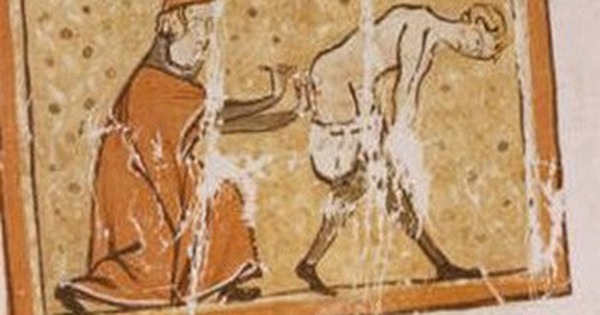 thumbnail - Thời cổ xưa con người từng dùng đỉa, than nóng để chữa bệnh trĩ