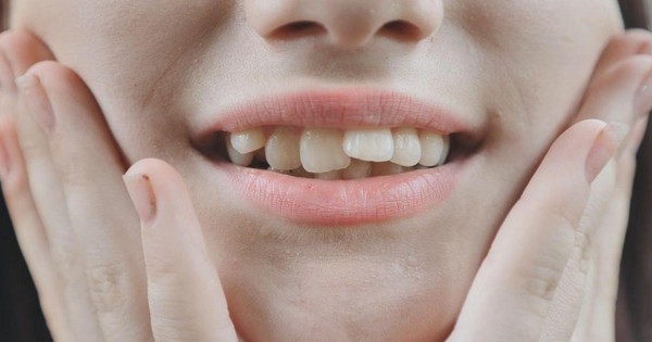 Răng vĩnh viễn mọc đều vào độ tuổi nào?
