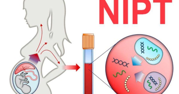 Xét nghiệm NIPT có nguy cơ gây ra tử vong cho thai nhi không?