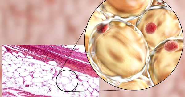 Kiểu chế độ ăn phù hợp cho những người kháng insulin?

