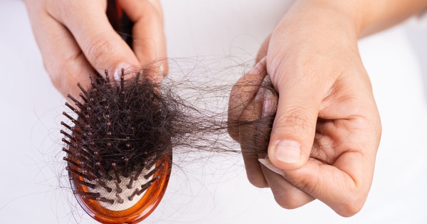 Thành phần chính của thuốc chống rụng tóc biotin là gì?
