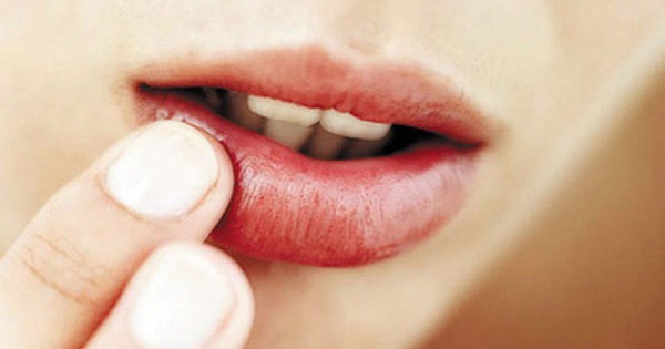 Khô miệng là triệu chứng của bệnh gì?
