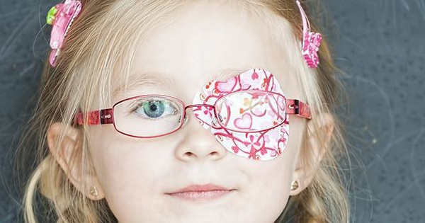Nhược thị ở trẻ em có khả năng chữa khỏi hoàn toàn không?
