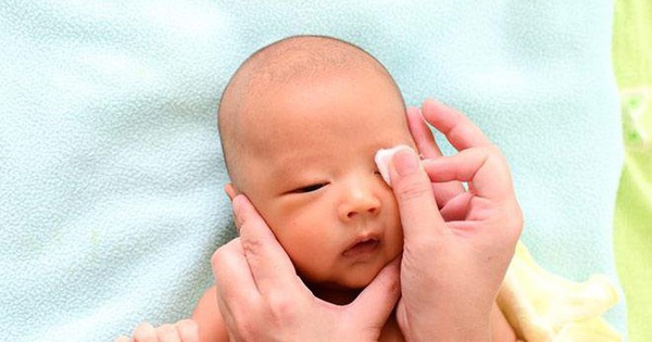 Có phương pháp nào để ngăn ngừa sụp mí mắt ở trẻ sơ sinh không?
