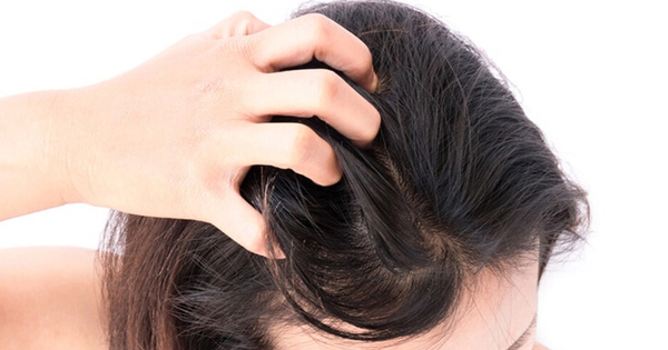 3 cách chăm sóc cho da đầu khỏe mạnh