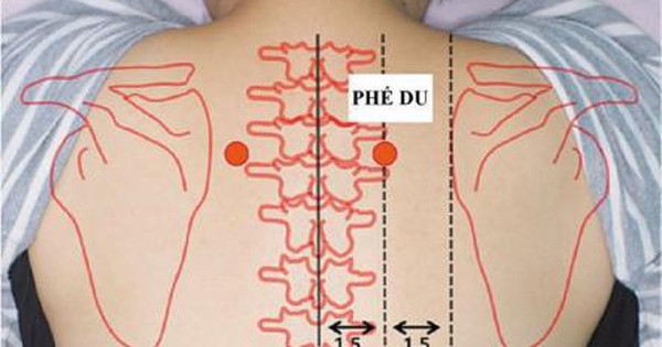 Thuật ngữ trong đơn huyệt và ý nghĩa của chúng là gì?
