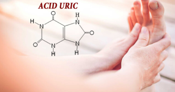 Chẩn đoán và điều trị nồng độ acid uric trong máu và bệnh gout hiệu quả tại nhà