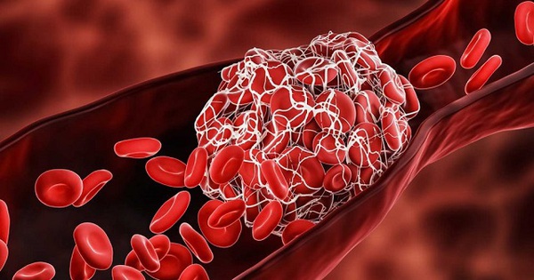 Có những biện pháp nào để phòng ngừa hiện tượng máu đông không hoạt động đúng cách?
