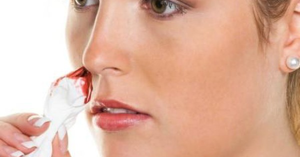 Khi nào cần đến bác sĩ khi chảy máu mũi?
