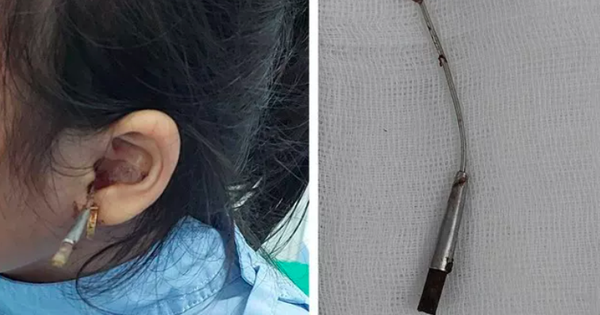Từ vụ bé 6 tuổi gặp nạn khi được lấy ráy tai, cảnh báo thói quen gây hại tai con nhiều cha mẹ mắc phải