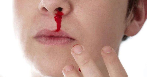 Trẻ em bị chảy máu mũi thường xảy ra trong trường hợp nào?
