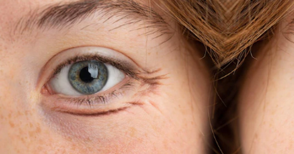 Có những loại mỹ phẩm và chăm sóc da nào có thể giúp giảm quầng thâm dưới mắt?
