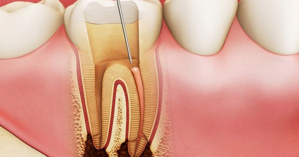 Những thông tin quan trọng về thuốc viêm lợi răng bạn cần biết