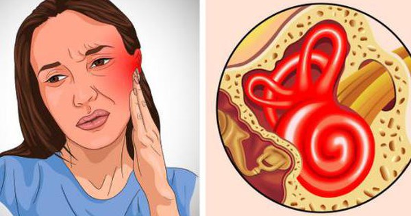 thumbnail - 6 dấu hiệu bị nhiễm trùng tai và cách phòng ngừa