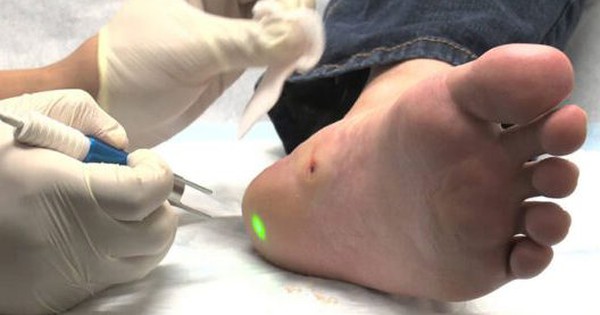 Cách điều trị và phòng ngừa bệnh mắt cá chân trong y học truyền thống là gì?
