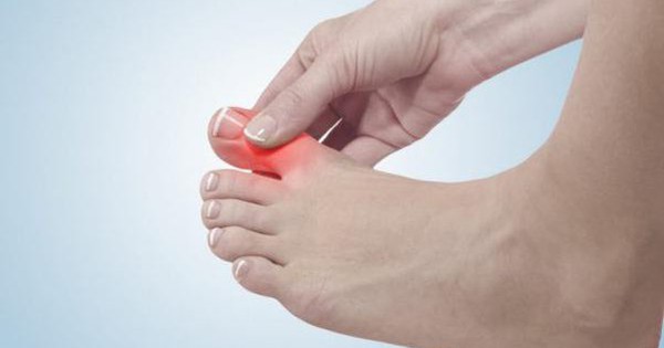 Nguyên nhân gây ra cơn đau gout trong cổ chân là gì? 
