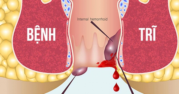 Những loại bệnh mà đơn huyệt có thể chữa được là gì?
