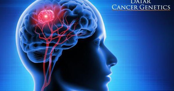 Có biện pháp phòng ngừa nào để giảm nguy cơ mắc u não?
