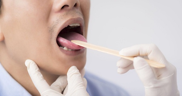 Rát lưỡi đau họng có ảnh hưởng đến thực hiện các hoạt động hàng ngày không?
