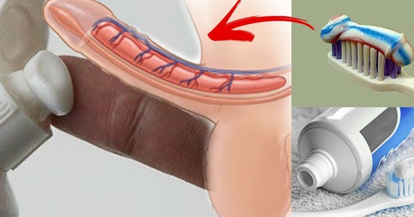 Bôi Kem Đánh Răng Vào Vùng Kín