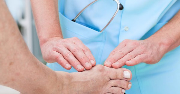 Bệnh gout ảnh hưởng đến cuộc sống và công việc hàng ngày của bệnh nhân như thế nào?
