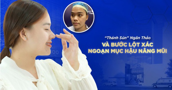 Thời gian hồi phục sau phẫu thuật sún răng là bao lâu?