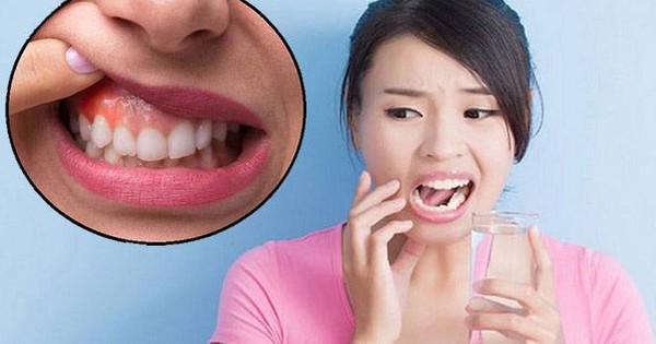 Khi nào nên tìm kiếm sự tư vấn và điều trị từ nha sĩ khi mắc phải viêm quanh răng?