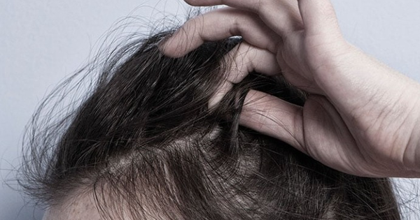 Quy trình lột da bằng thuốc uốn tóc cần tuân thủ những bước nào để đạt hiệu quả tốt nhất?
