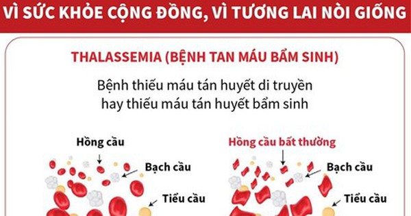 Đẩy Lùi Bệnh Tan Máu Bẩm Sinh Vì Sức Khỏe Cộng đồng Và Nòi Giống