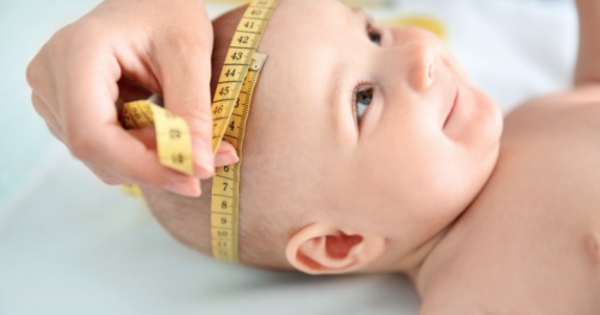 Giãn não thất ở trẻ sơ sinh có liên quan đến việc ăn uống không?
