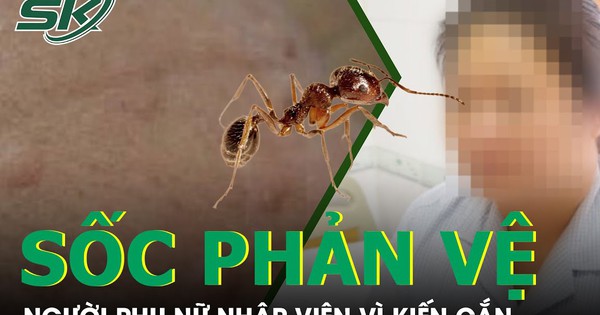 Điều trị cấp cứu sốc phản vệ tại nhà có thể thực hiện như thế nào?
