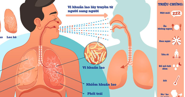 Lao phổi yếu tố nguy cơ và cách phòng ngừa