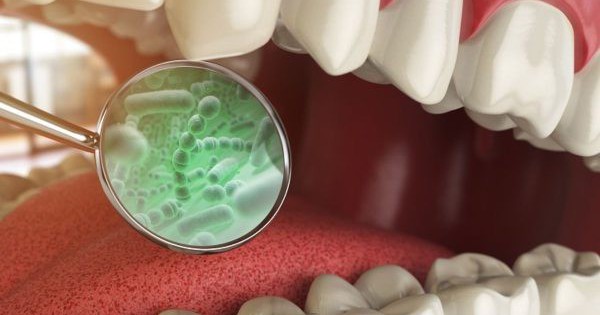  Vi khuẩn trong khoang miệng : Những thông tin cần biết