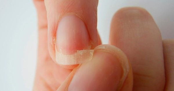 Không để móng tay quá dài