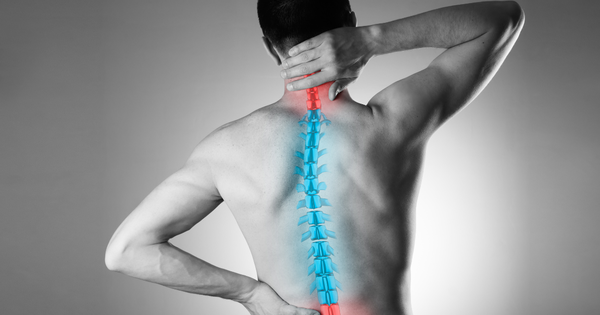 Dấu hiệu cảnh báo loãng xương sớm như đau lưng, cong cột sống và giảm chiều cao