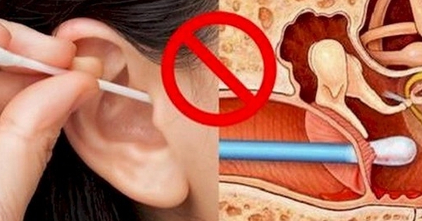 Cai Lay Rai Tai Lấy ráy tai không đúng cách nguy hiểm như thế nào?