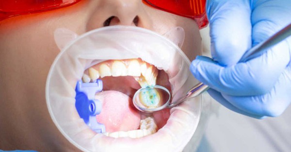 Cách giúp răng chắc khỏe, sáng bóng, ngừa sâu răng