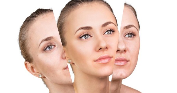 3 dấu hiệu nhận biết lão hóa da