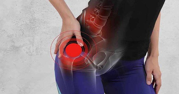 Cơn đau vùng bẹn và hông là dấu hiệu sớm cảnh báo tình trạng hoại tử xương đùi