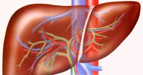 Bệnh gan có thể gây ra những biến chứng gì nếu không được điều trị đúng cách?
