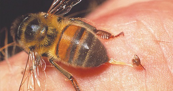 Chúng ta đều biết rằng ong đốt là rất nguy hiểm đối với trẻ em. Hình ảnh này sẽ cho bạn những giải pháp an toàn và hiệu quả để phòng và trị ong đốt cho trẻ nhỏ. Cùng học hỏi để bảo vệ con cái của mình khỏi sự nguy hiểm này.