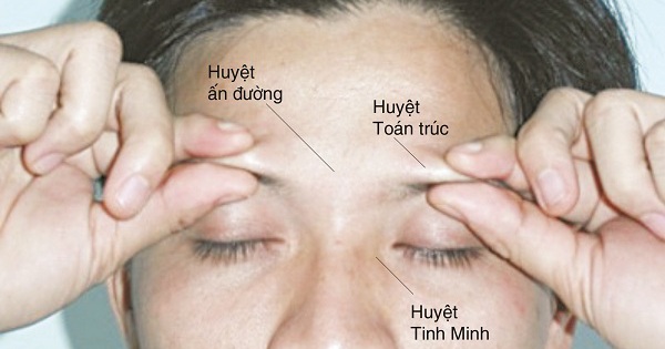 What are some acupressure techniques to treat sinusitis on the forehead?