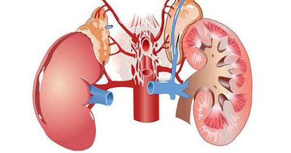 Viêm phổi kẽ ở trẻ em là bệnh gì?