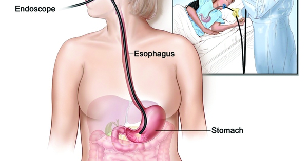 Làm thế nào để chẩn đoán và xác định loét hang vị dạ dày?
