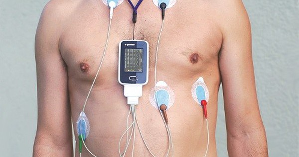 Máy đo huyết áp liên tục hoạt động như thế nào?
