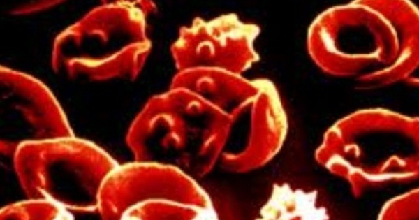 Tác động và tình trạng sức khỏe của người bị tăng 3 dòng tế bào máu là như thế nào?
